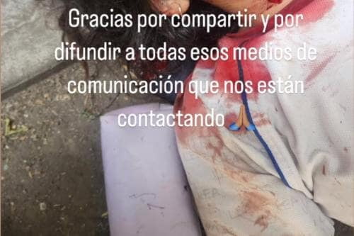 Apenas tiene 13 agnos y ya es sobreviviente de intento de feminicidio